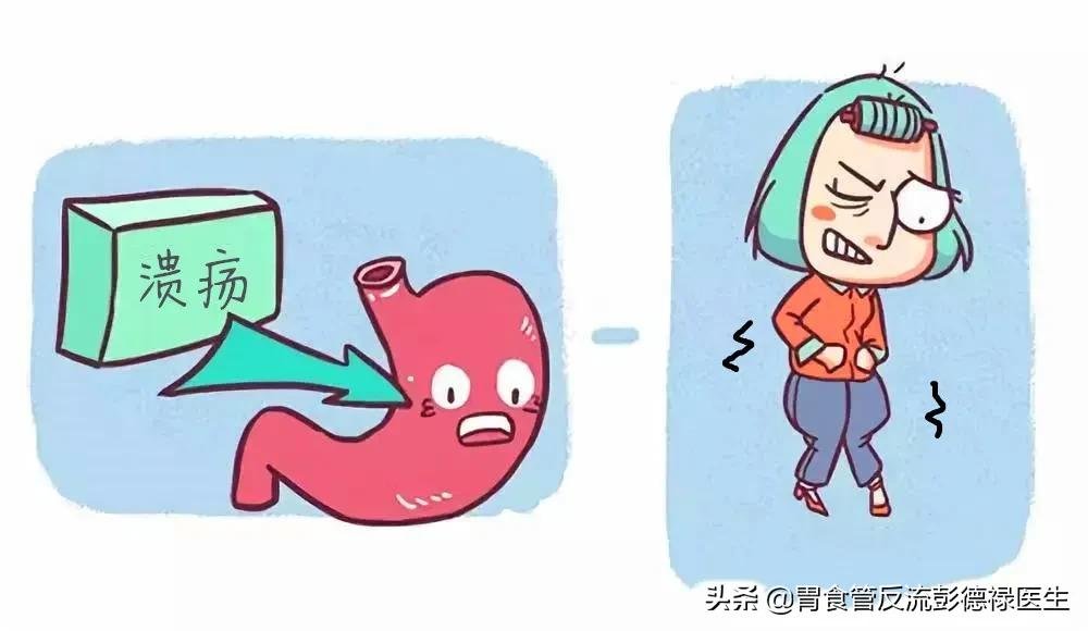 胃溃疡症状_胃溃疡_胃溃疡饮食禁忌