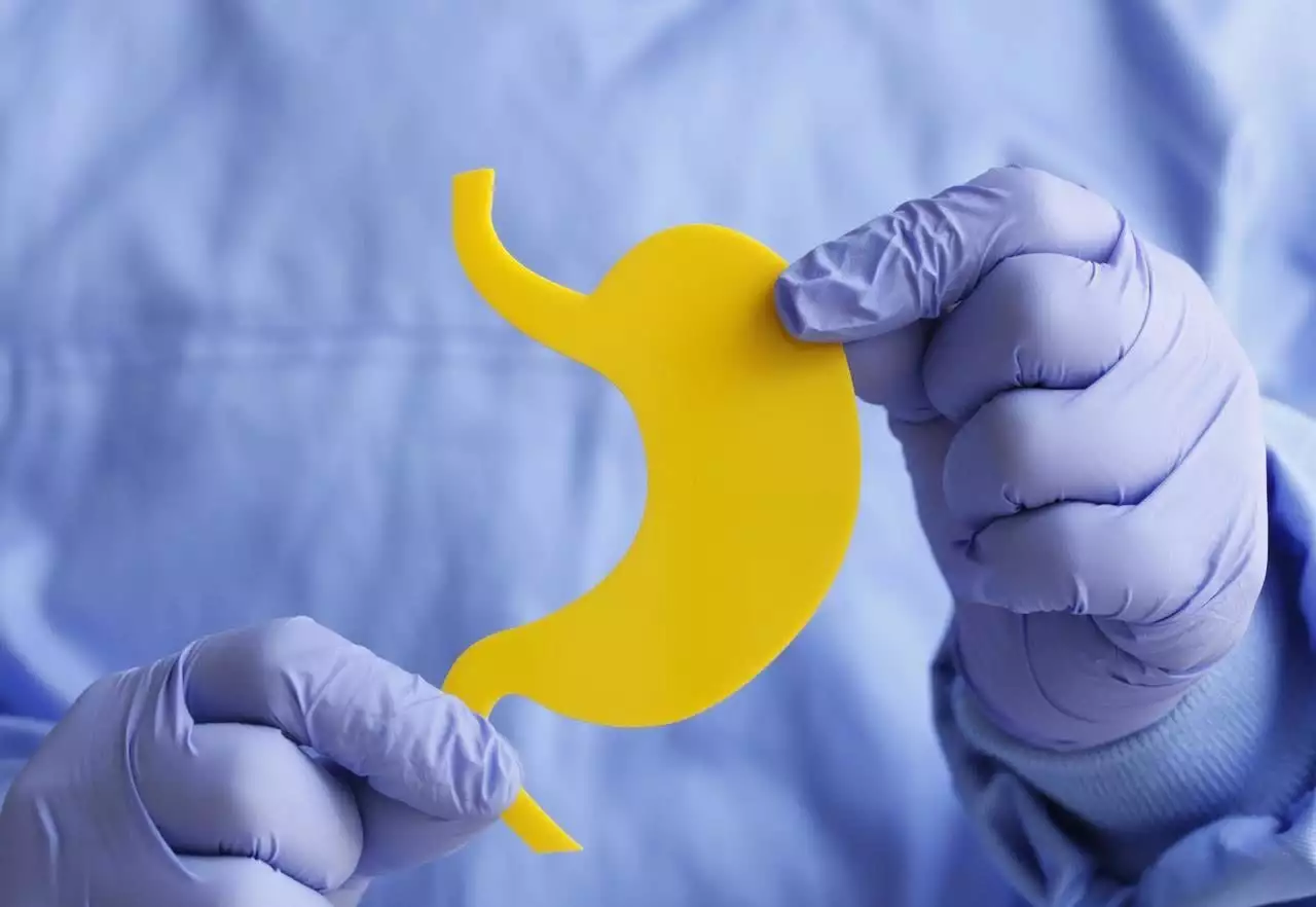 胃溃疡_如何科学治疗胃溃疡_胃溃疡反复原因