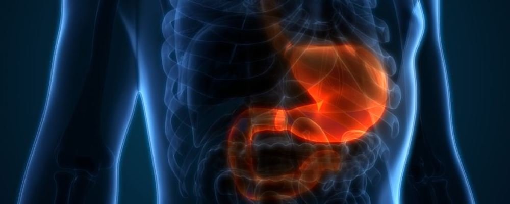 _胃溃疡并发穿孔的症状及体征_胃溃疡穿孔多发生在哪个部位